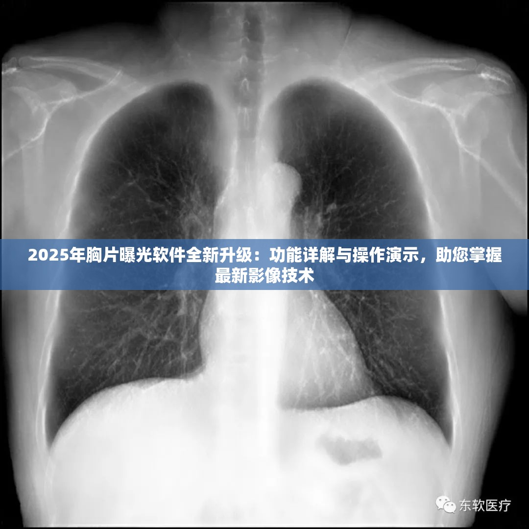 2025年胸片曝光軟件全新升級(jí)：功能詳解與操作演示，助您掌握最新影像技術(shù)
